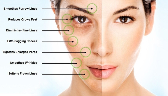 EINECS 232-678-0 Bột axit hyaluronic 2000- 5000 Dalton Bột huyết thanh axit hyaluronic tinh khiết